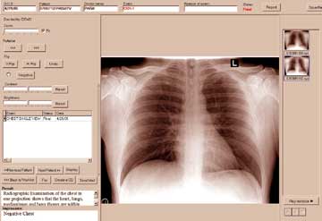 HHRS viewer